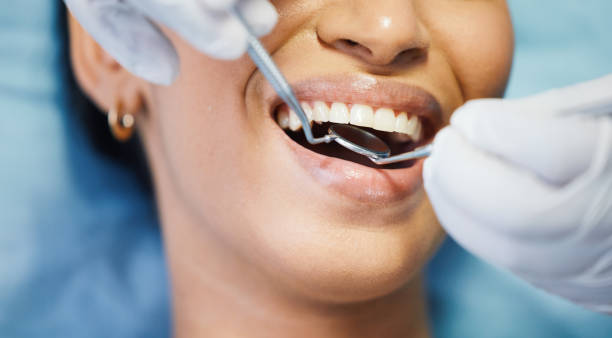 Best Emergency Treatment for Dental Infections or Abscesses in Woodland Park, CO
