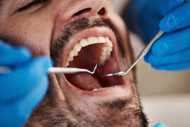 Best Urgent Care for Lost Fillings or Crowns in Woodland Park, CO