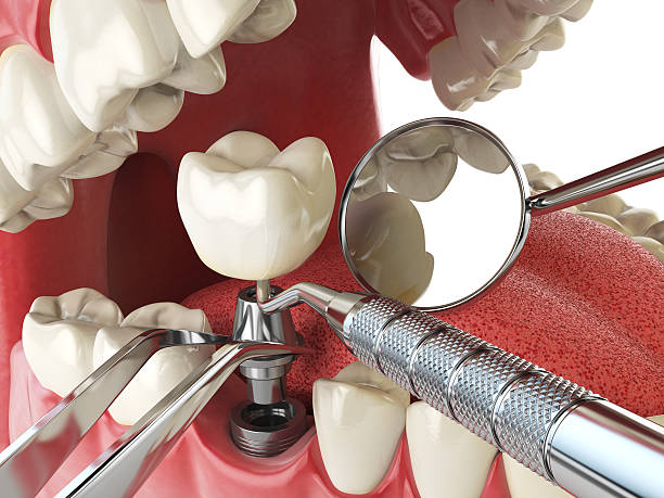 Best Emergency Gum Treatment in Woodland Park, CO